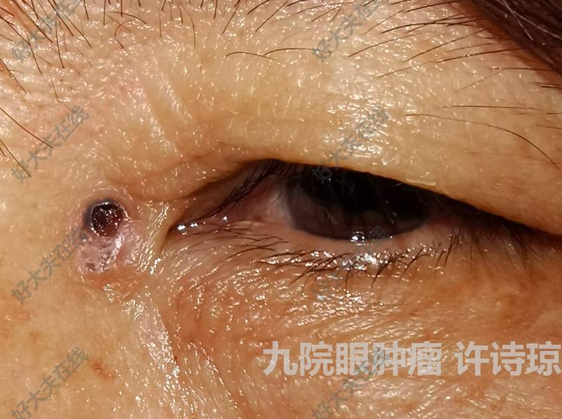 圖文圖片