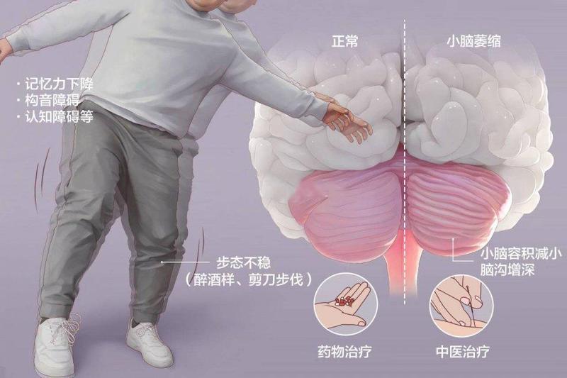 圖文圖片