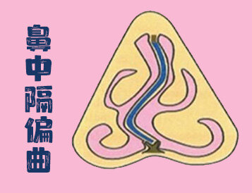 圖文圖片