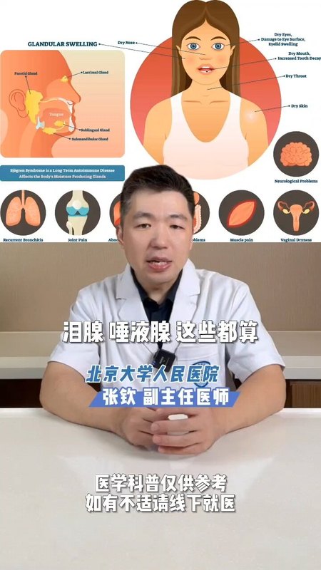 得了干燥综合征一定会眼干吗？ 一定会得干眼症吗？＃干眼症 ＃干燥综合征 ＃人工泪液 ＃结膜炎 ＃眼科