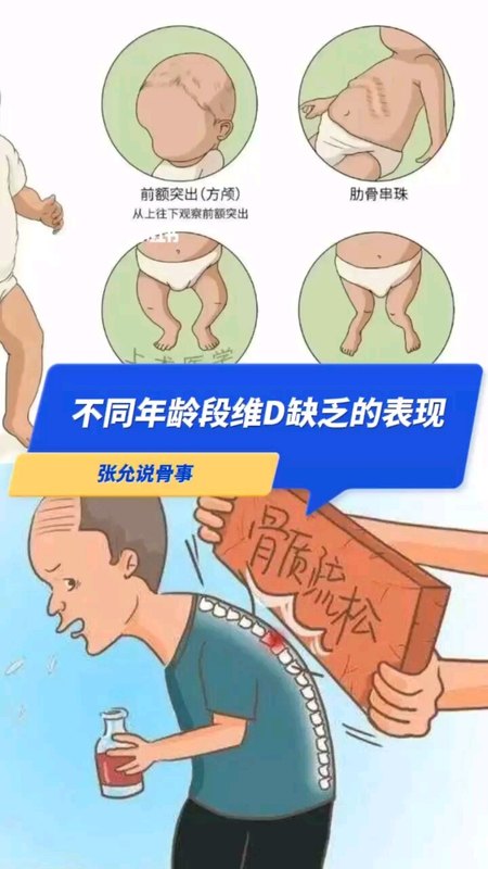 不同年龄段维生素D缺乏的表现