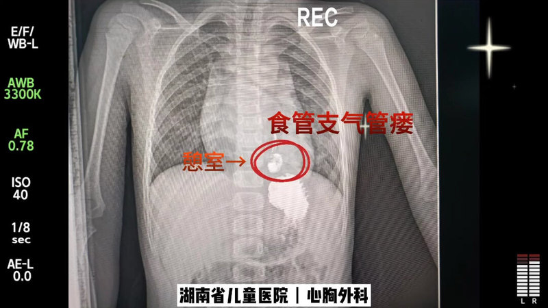 視頻封面