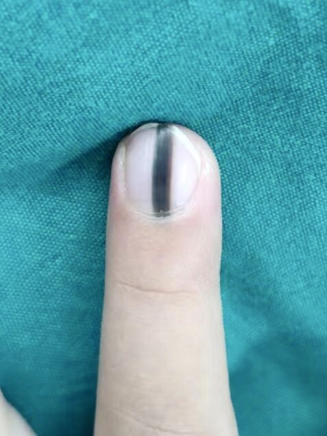 圖文圖片