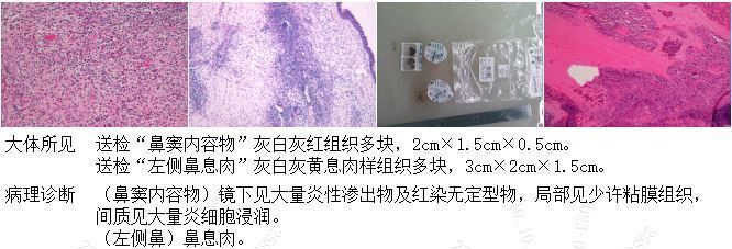 圖文圖片