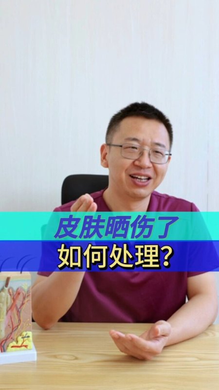 皮肤晒伤了，如何处理？