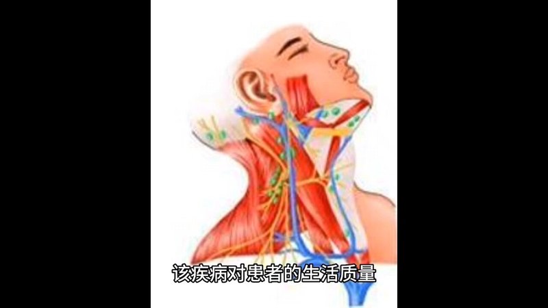 慢性咽喉炎科普