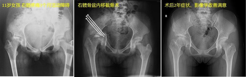 圖文圖片