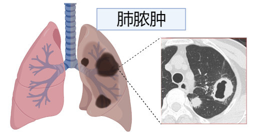 圖文圖片