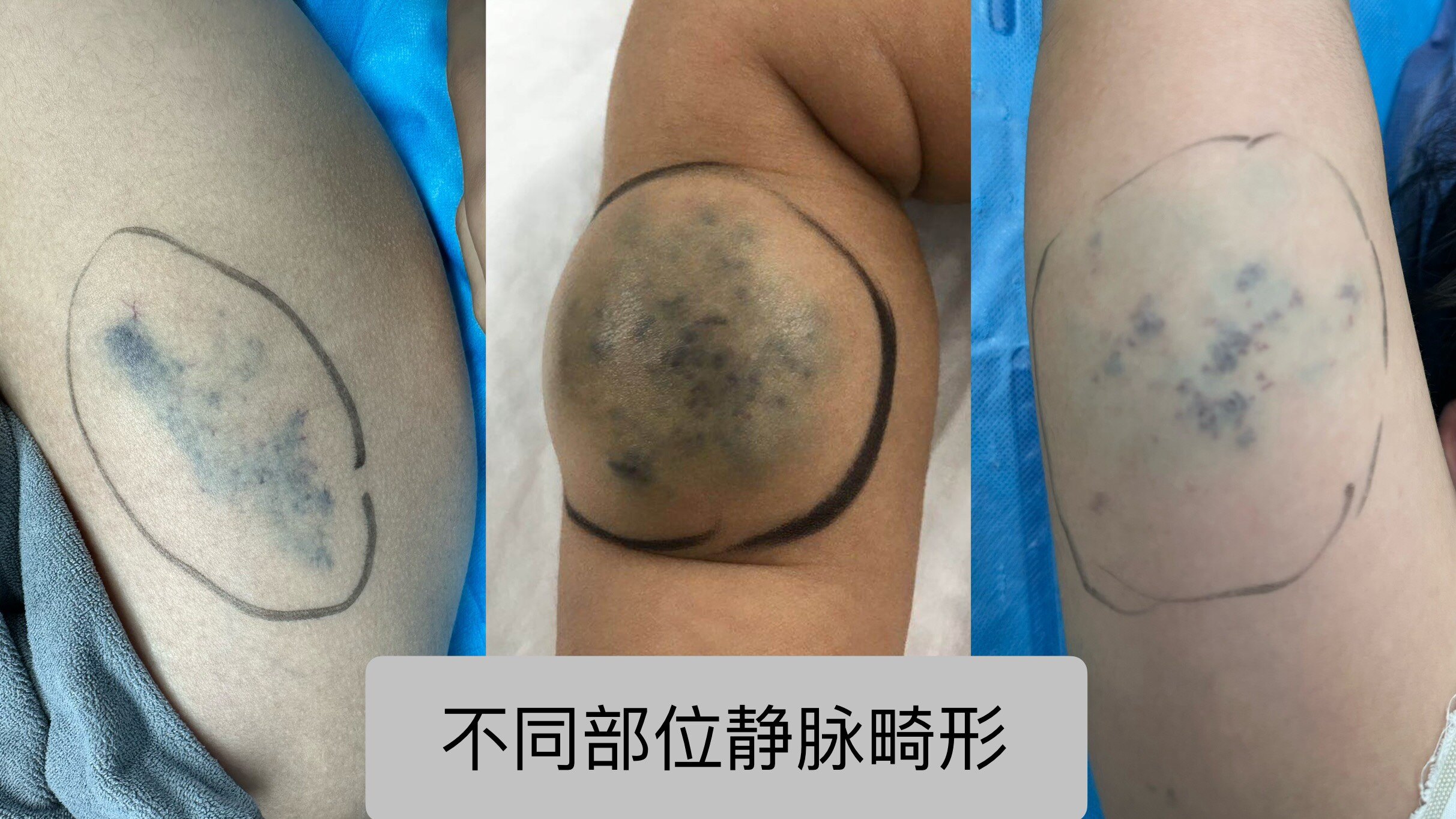 圖文圖片