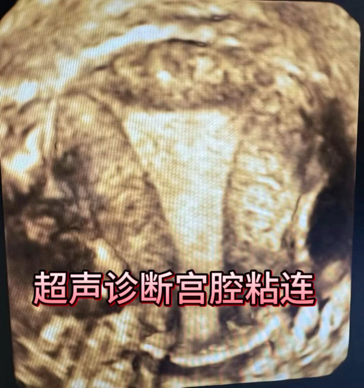視頻封面