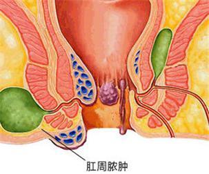 圖文圖片