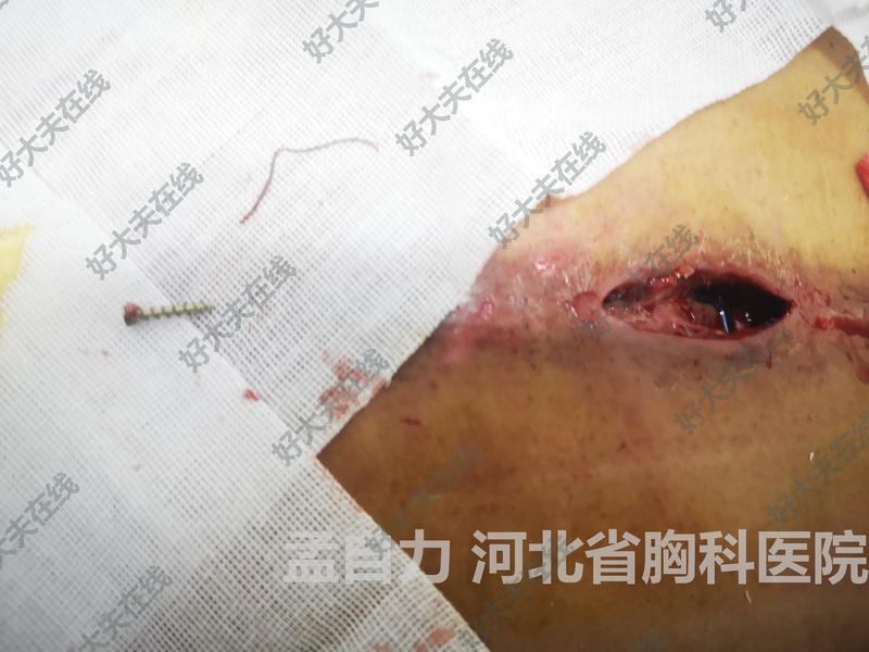 圖文圖片