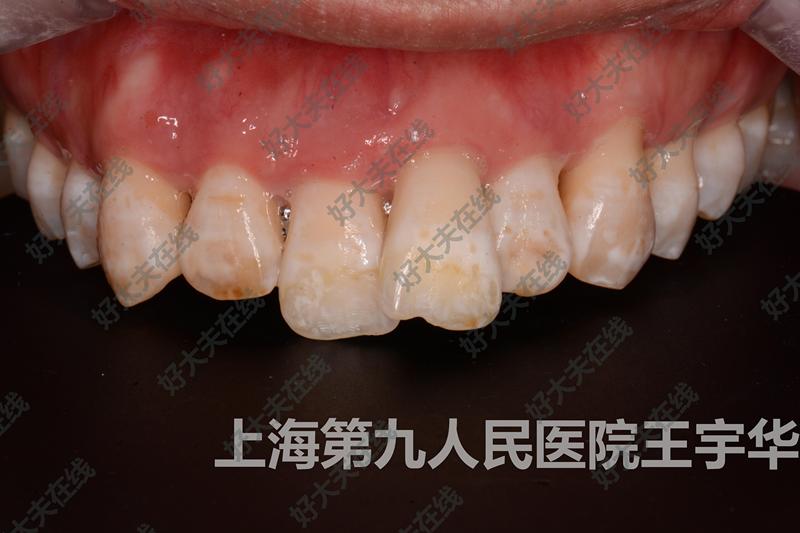 圖文圖片