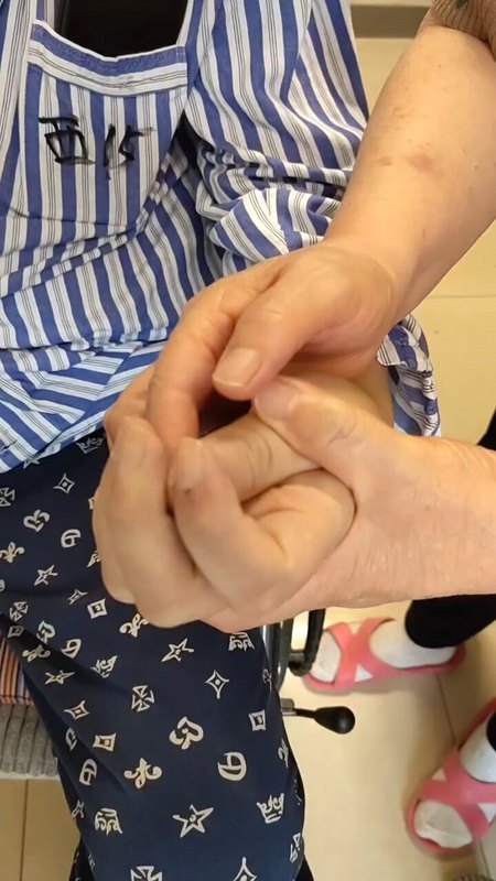 颈七手术可以明显改善脑出血，脑梗死后肢体偏瘫的功能，降低偏瘫肢体的肌张力，是偏瘫患者恢复的希望