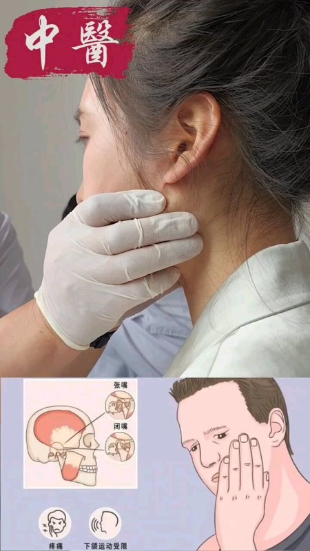 中医手法治疗颞下颌关节紊乱导致的大小脸