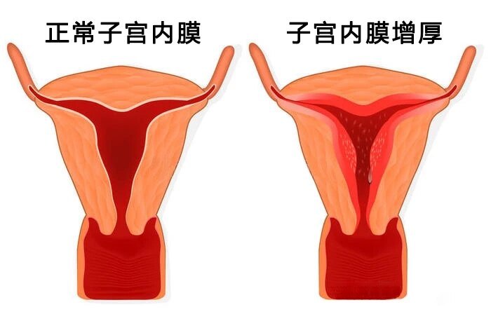 圖文圖片