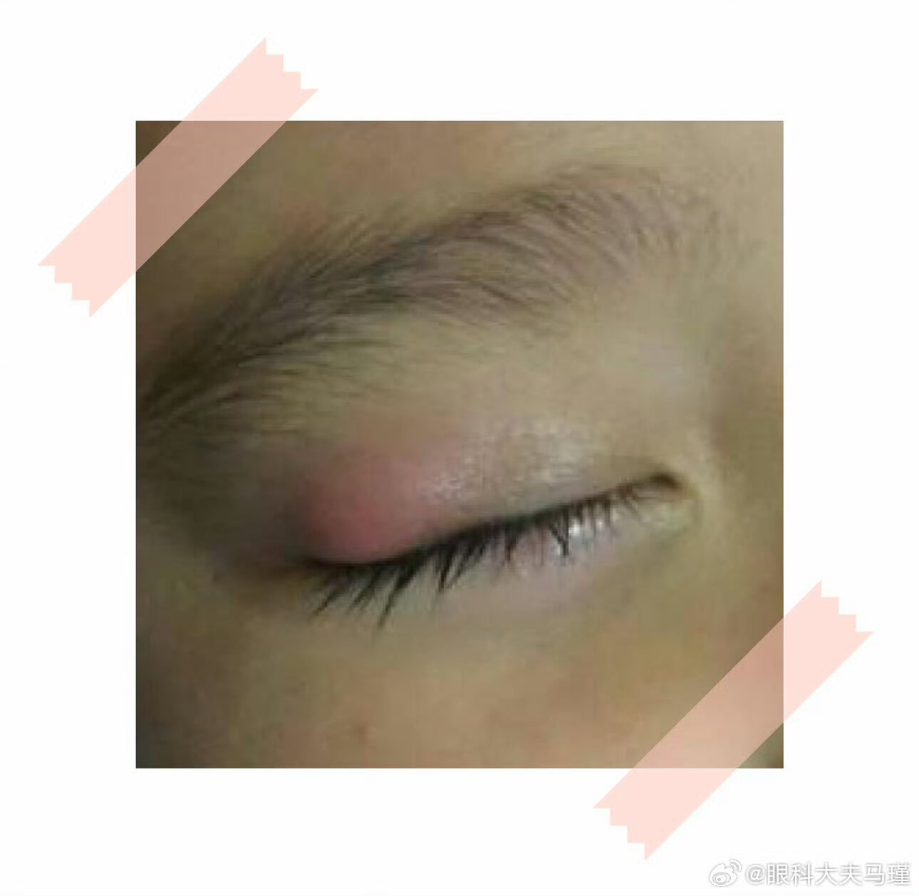 圖文圖片