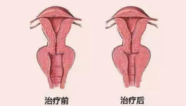 圖文圖片