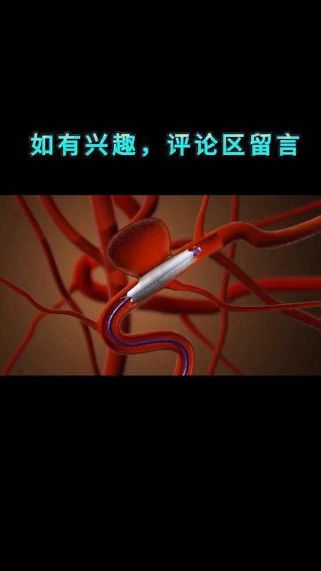 視頻封面