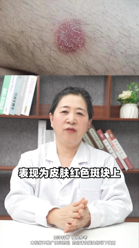 視頻封面