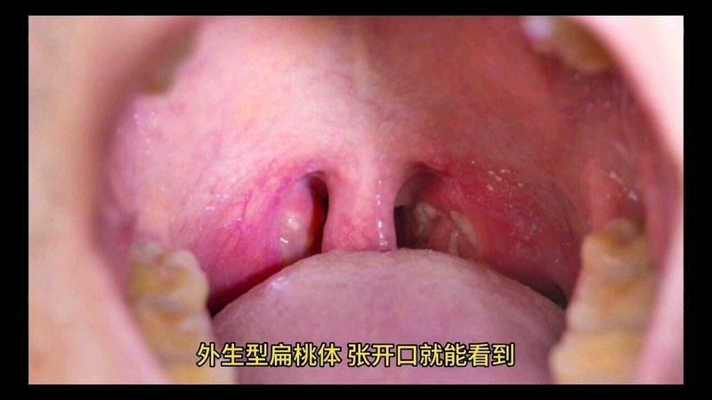視頻封面