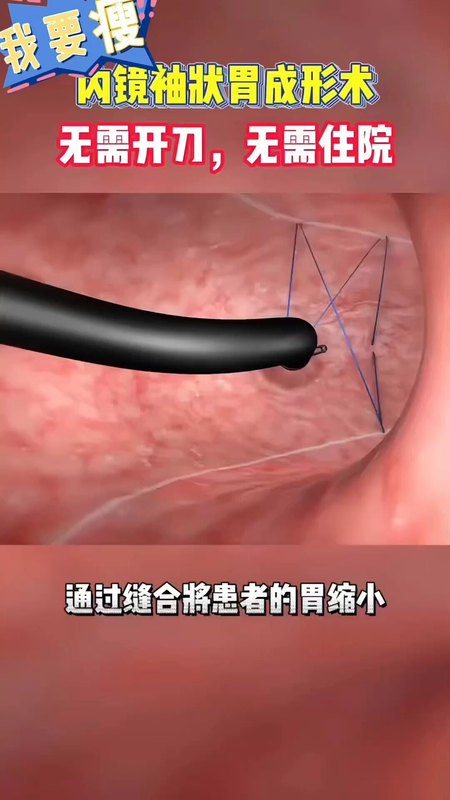 視頻封面