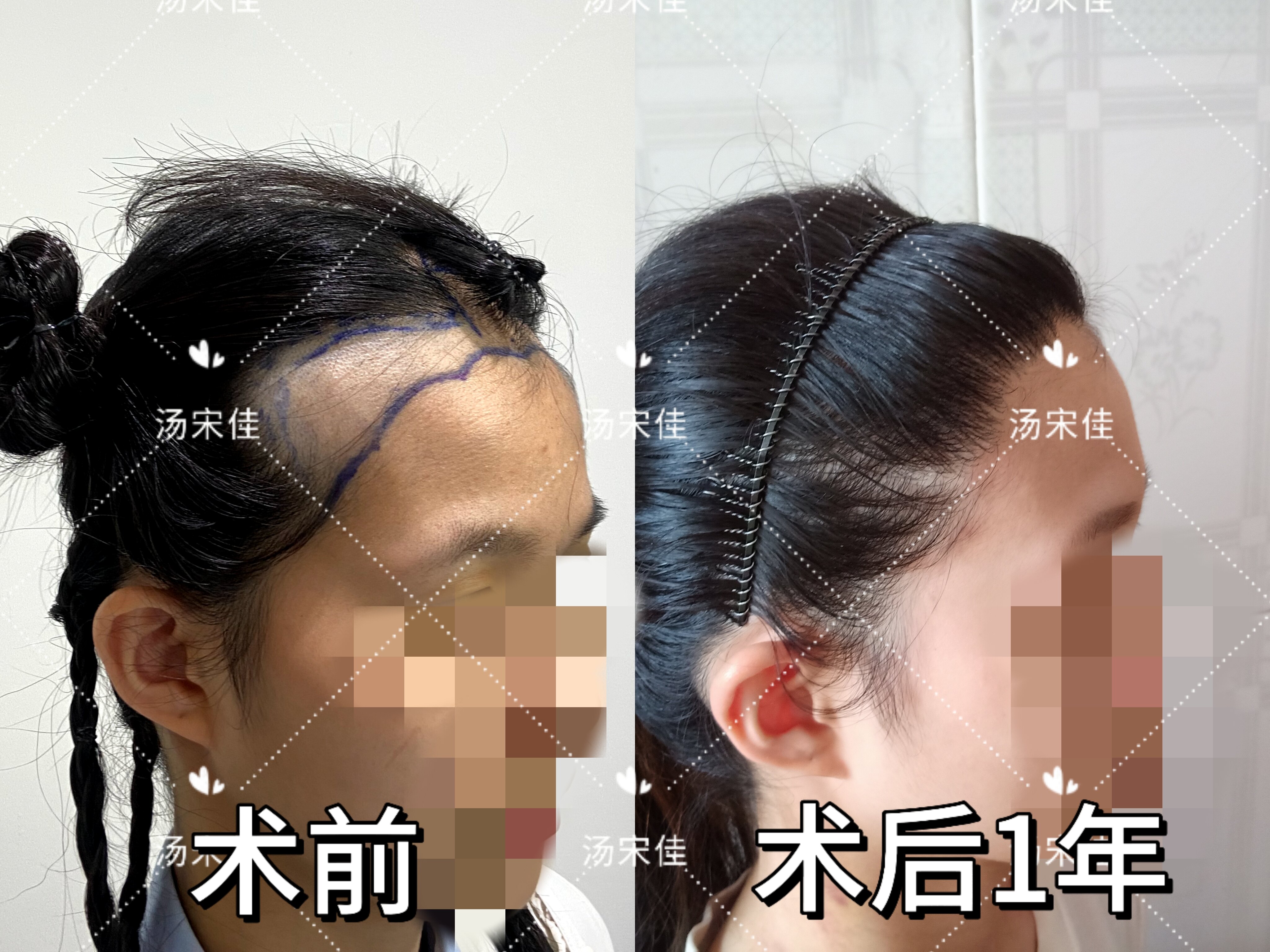 圖文圖片