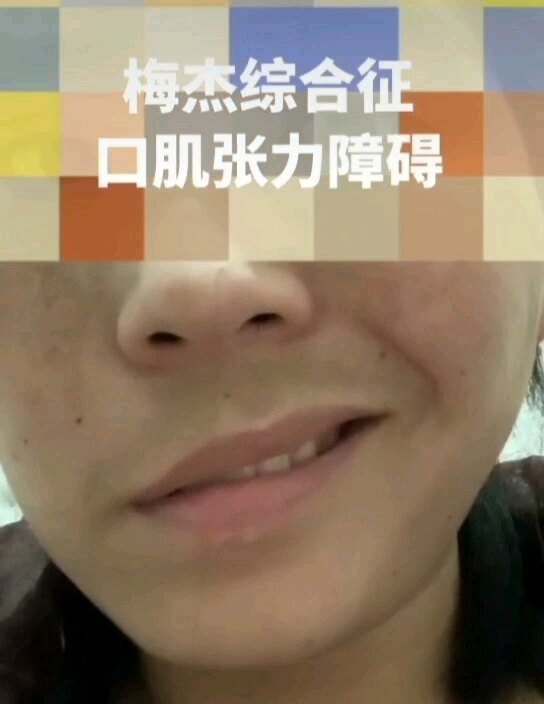 視頻封面