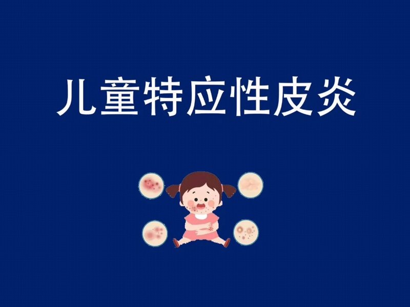 儿童特应性皮炎