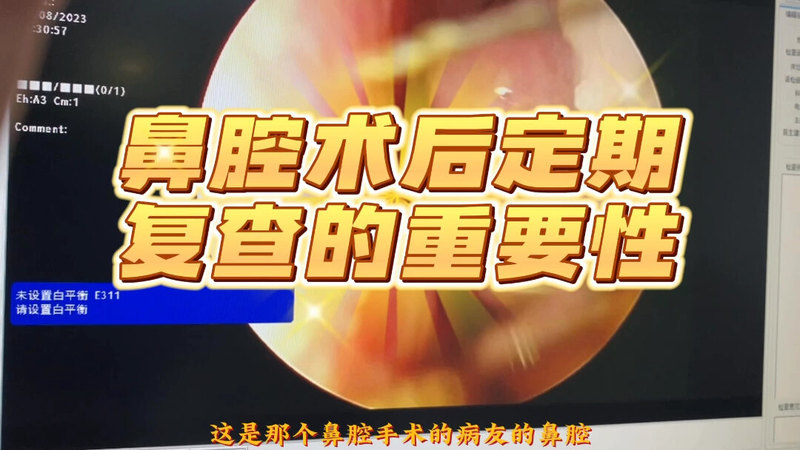 視頻封面