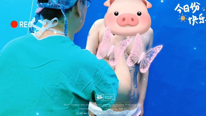 腰腹手臂吸脂画线