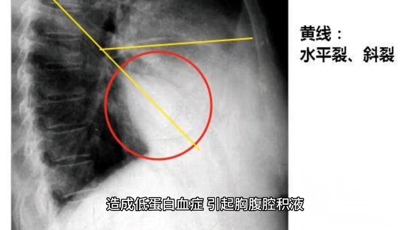 視頻封面