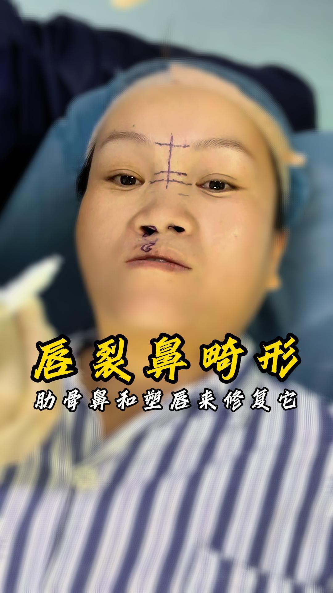 圖文圖片