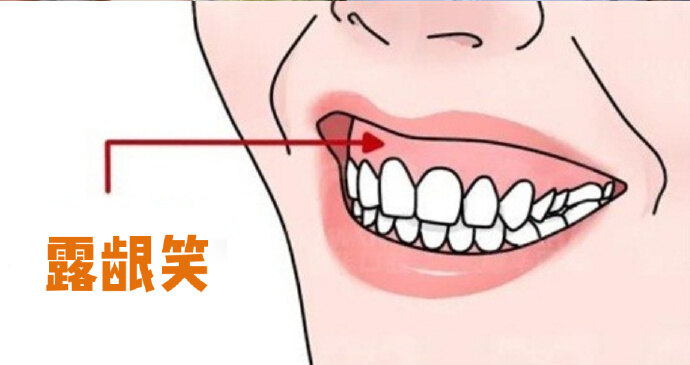 圖文圖片