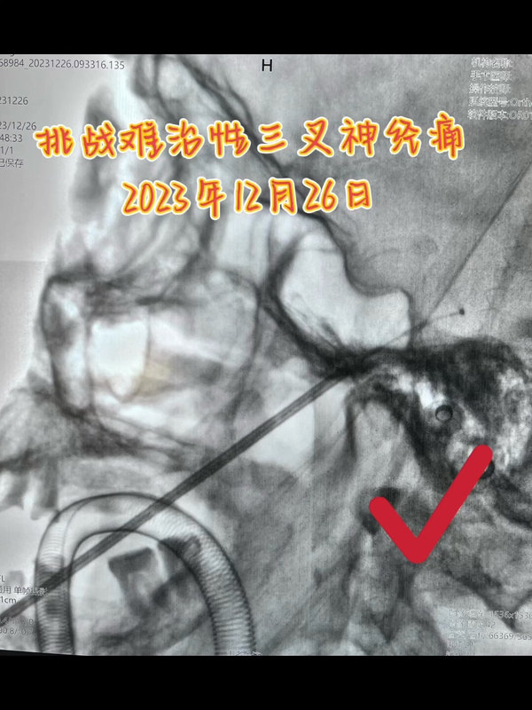 視頻封面