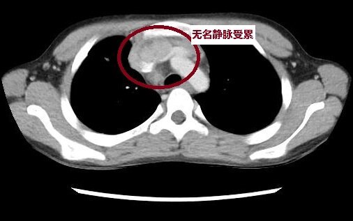 圖文圖片