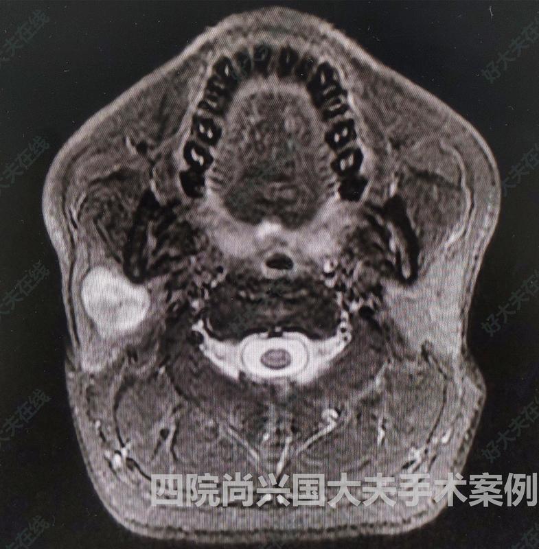 圖文圖片