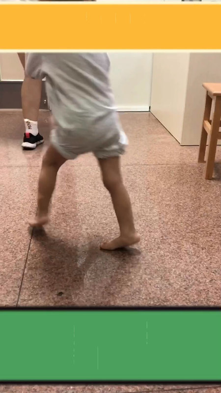 尖足步态/踮脚走路