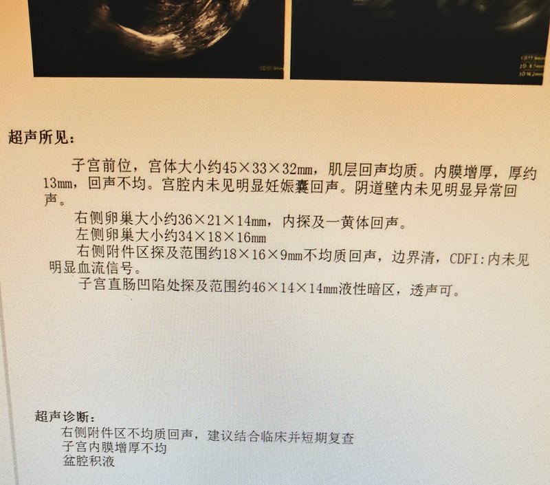 圖文圖片