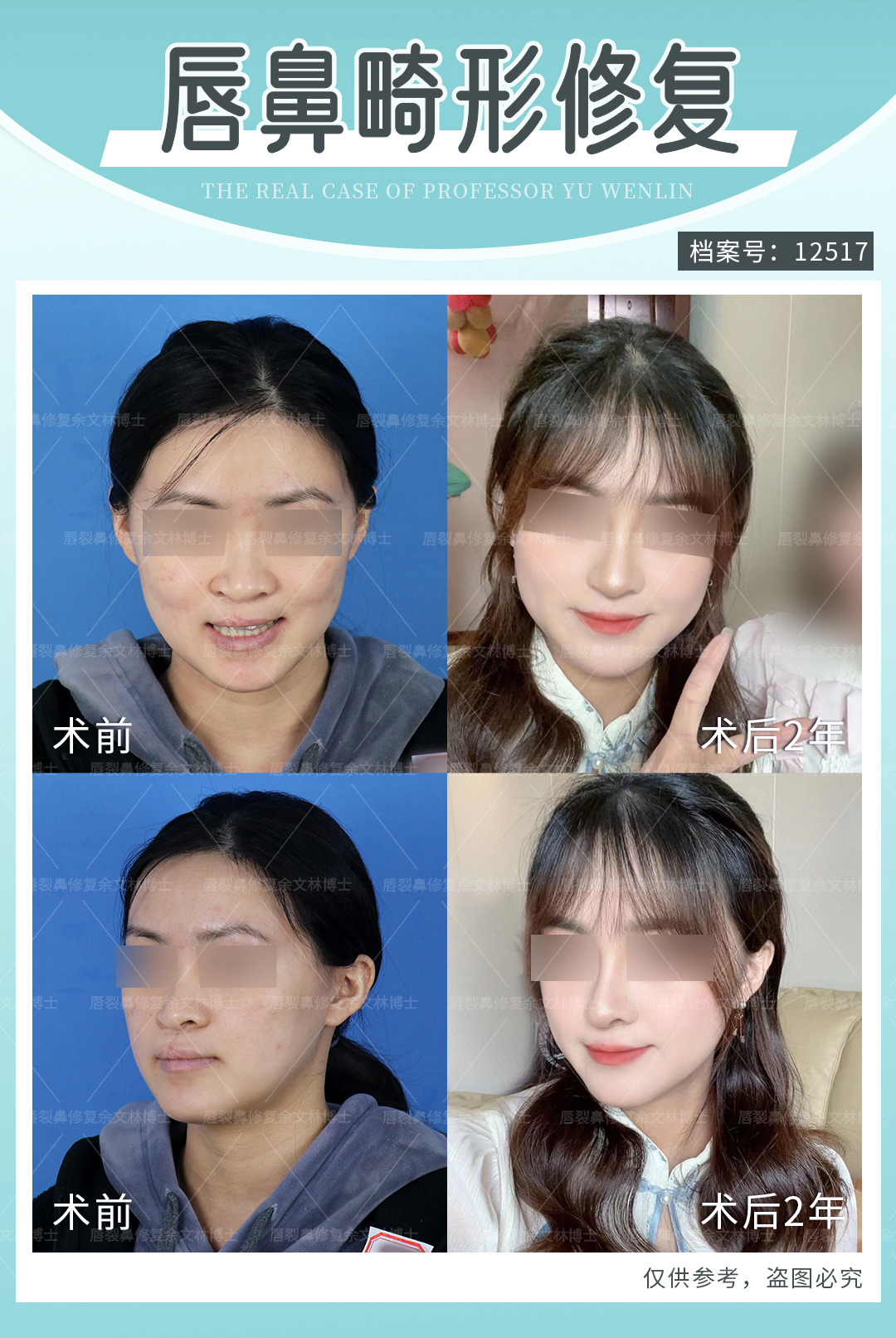 圖文圖片