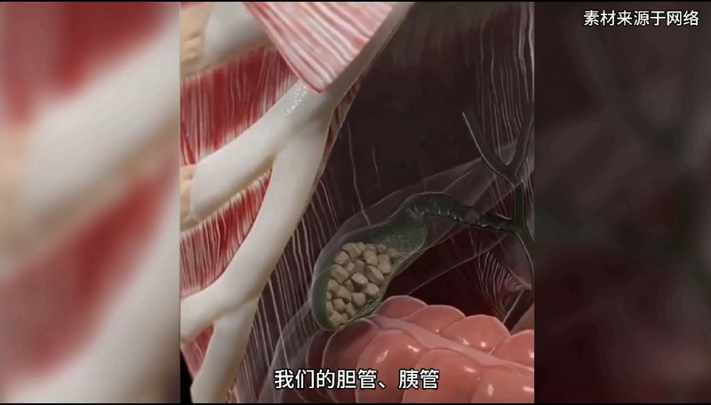 解决胆管结石，可以不开刀！