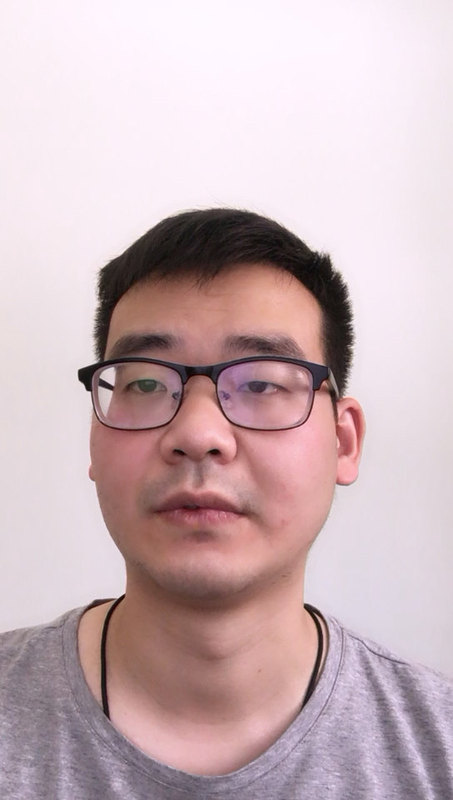 心动过缓的发病原因