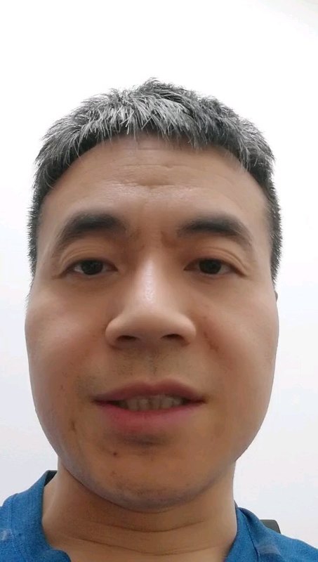 痛风性关节炎怎么治疗