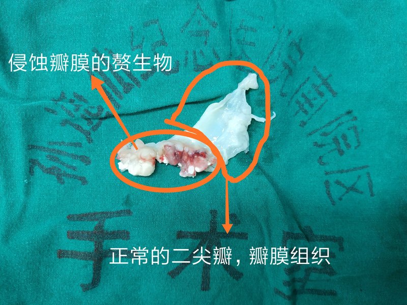 圖文圖片