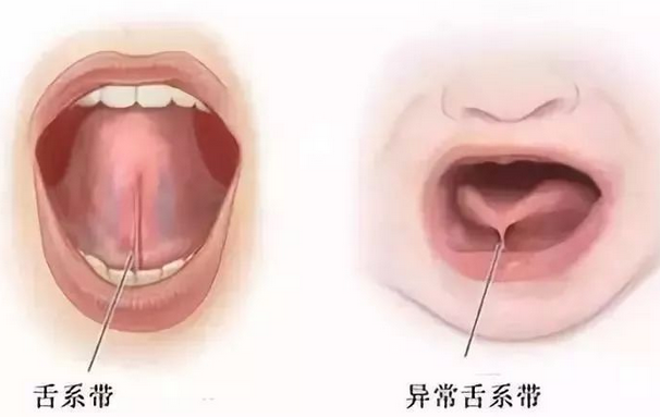 圖文圖片