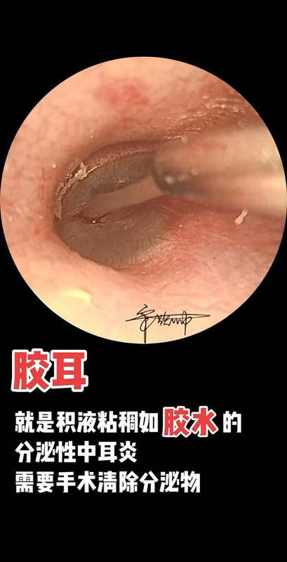 視頻封面