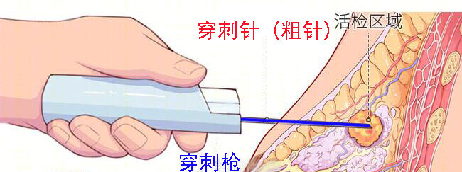 圖文圖片