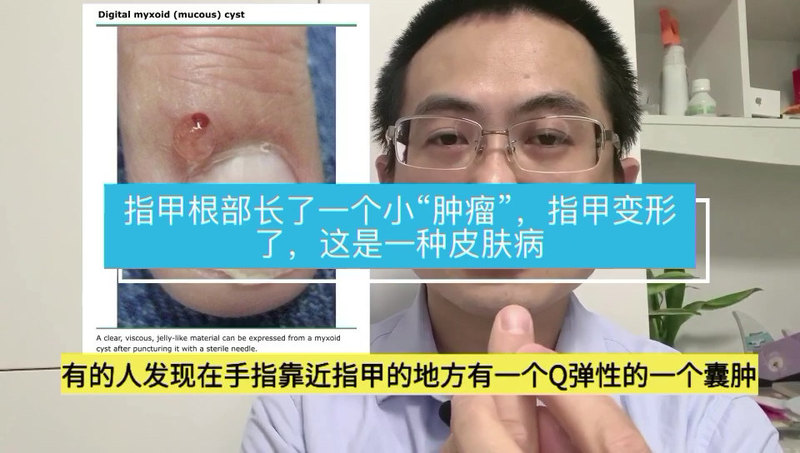 視頻封面
