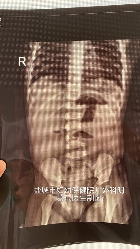 圖文圖片