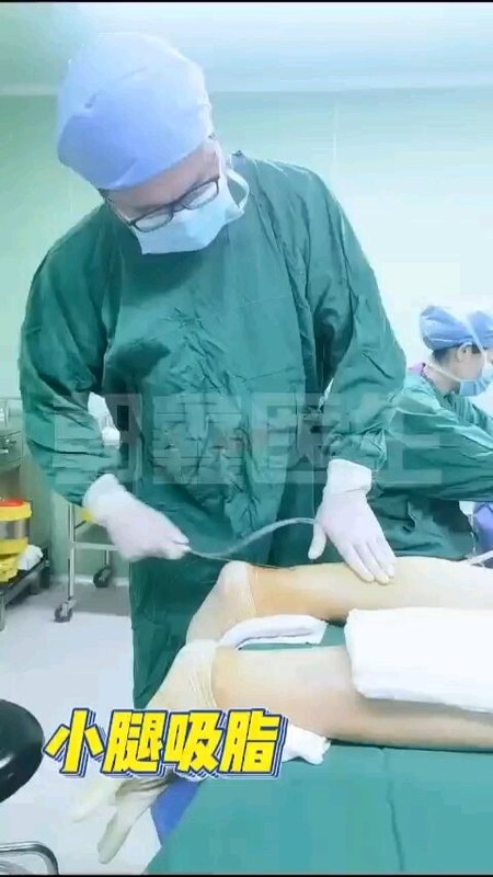 局麻状态下小腿吸脂